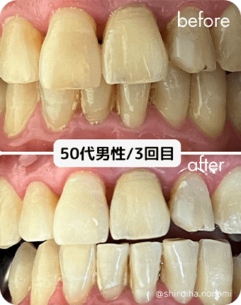50代男性/3回目